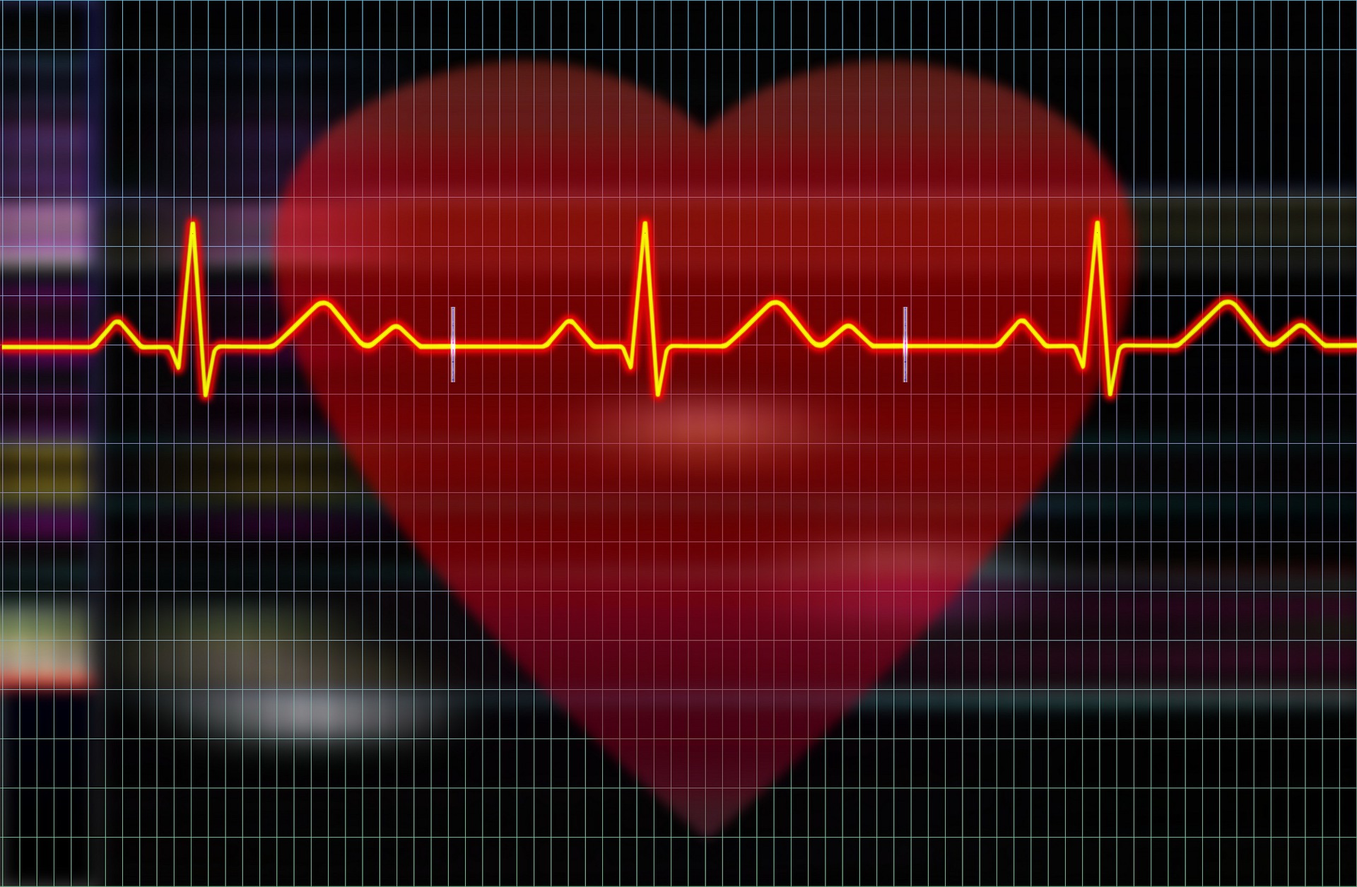 Co po zawale serca? Profilaktyczne monitorowanie serca holterem EKG.